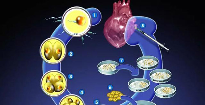 Prelevarea de celule stem in 8 pasi