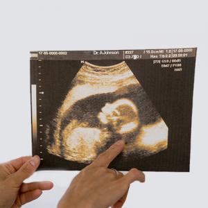 Teste obligatorii in sarcina